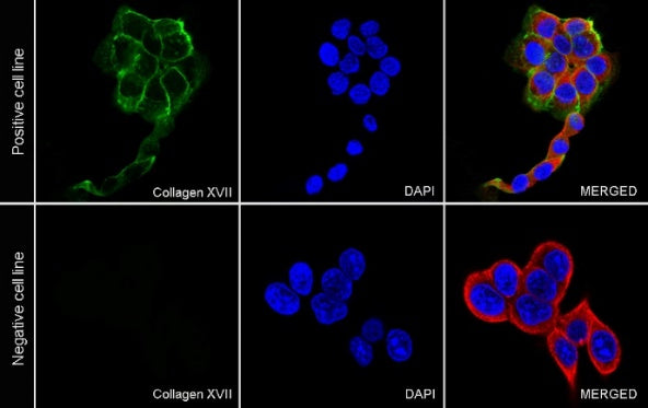 Collagen XVII Recombinant Rabbit mAb (S-1636-5)
