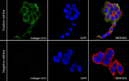Collagen XVII Recombinant Rabbit mAb (S-1636-5)