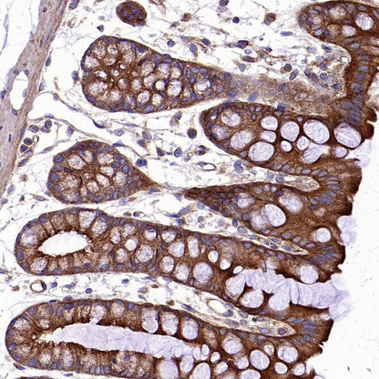 KIF5B+KIF5C Recombinant Rabbit mAb (S-2452-15)