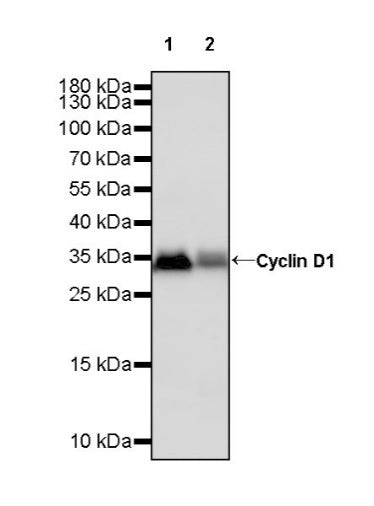 Cyclin D1 Recombinant Rabbit mAb (SDT-R423)