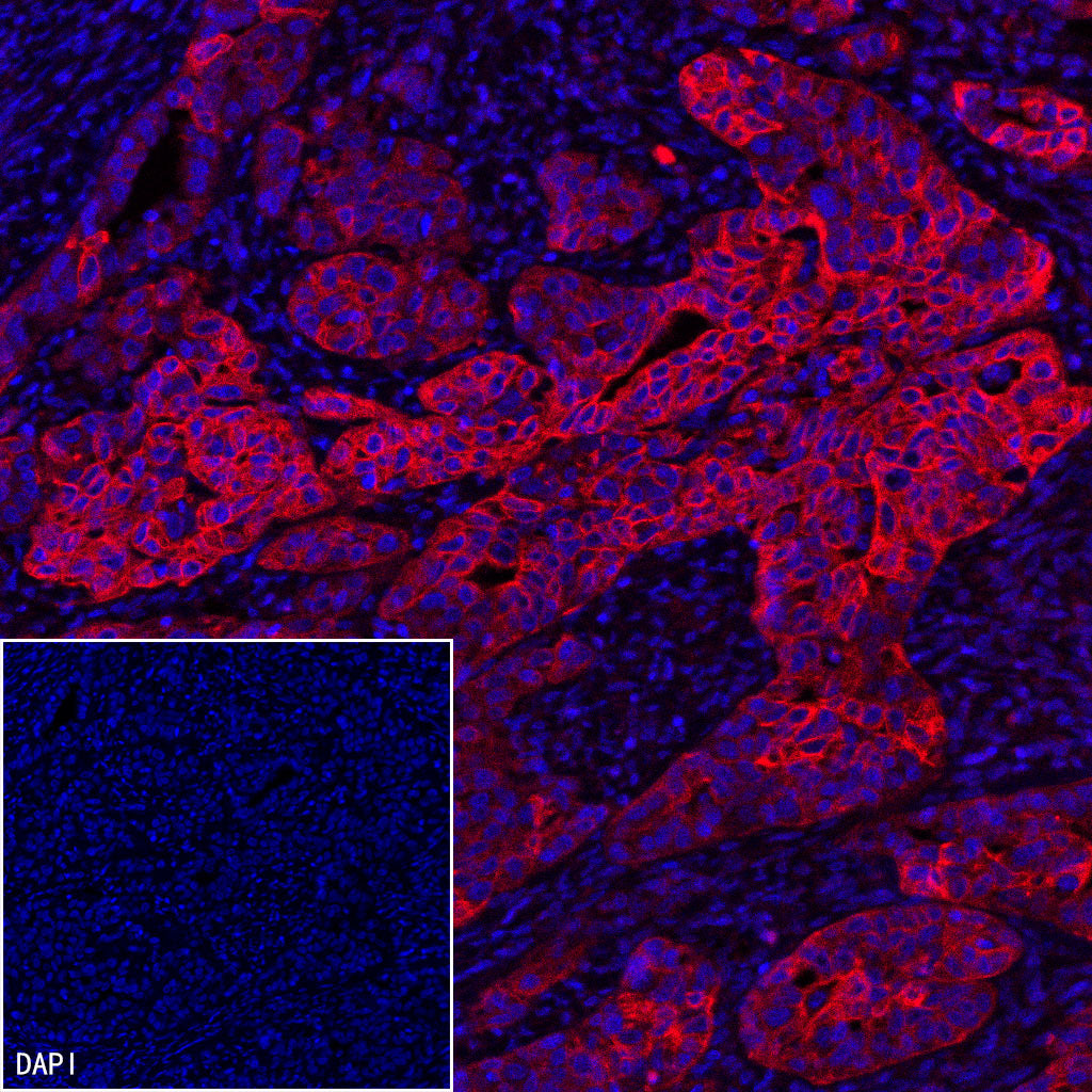 RRM1 Recombinant Rabbit mAb (SDT-R152)