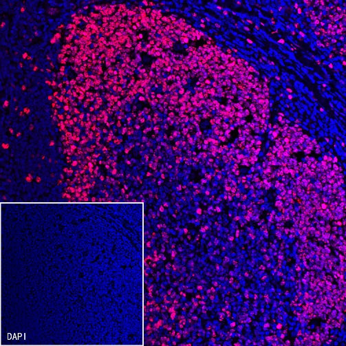 Ki67 Recombinant Rabbit mAb (Alexa Fluor® 555 Conjugate) (SDT-R459)