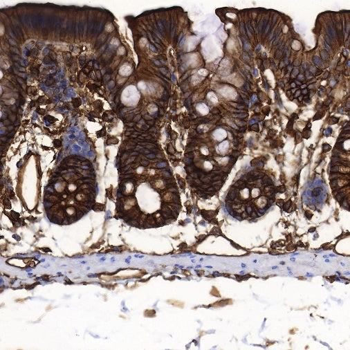 S-RMab®Annexin A2 Recombinant Rabbit mAb (SDT-444-67)