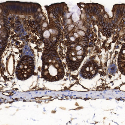 S-RMab®Annexin A2 Recombinant Rabbit mAb (SDT-444-67)