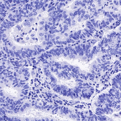 α/β-Synuclein Recombinant Rabbit mAb (S-309-72)