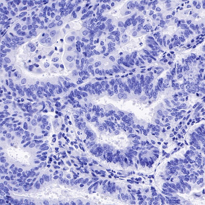 α/β-Synuclein Recombinant Rabbit mAb (S-309-72)