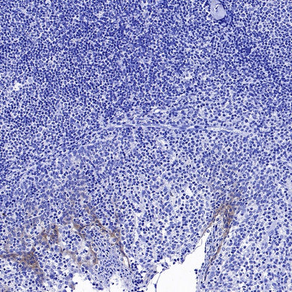 ErbB3 Recombinant Rabbit mAb (SDT-991-73)