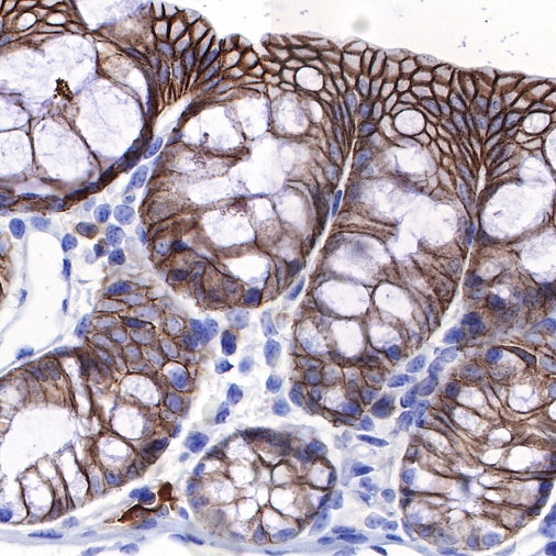 S-RMab® Cadherin 17 Recombinant Rabbit mAb (SDT-736-23)