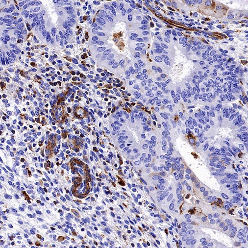 VISTA Recombinant Rabbit mAb (S-1469-72)