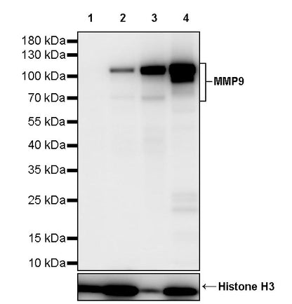 MMP9 Recombinant Rabbit mAb (S-3915-36)