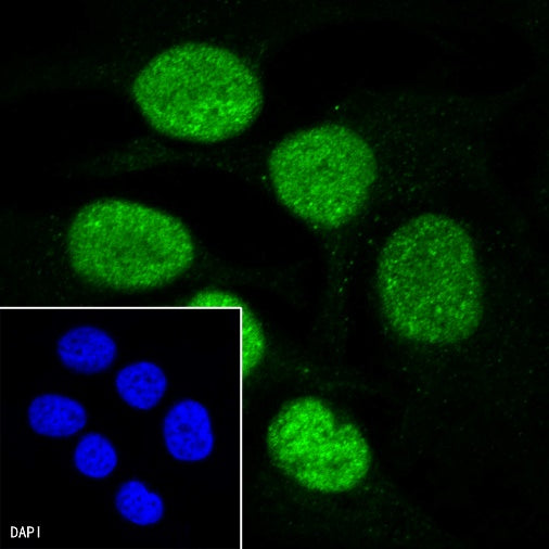 PMS2 Recombinant Rabbit mAb (SDT-111-307)