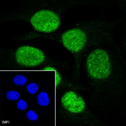 PMS2 Recombinant Rabbit mAb (SDT-111-307)