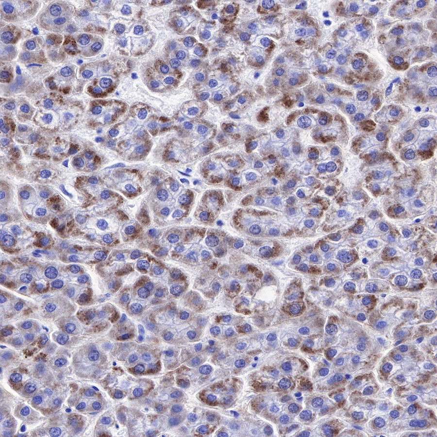 NY-ESO-1 Recombinant Rabbit mAb (SDT-R154)