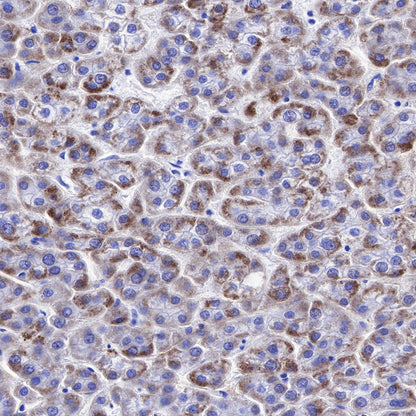 NY-ESO-1 Recombinant Rabbit mAb (SDT-R154)