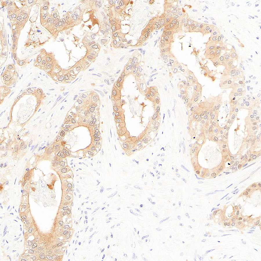 Rad51C Recombinant Rabbit mAb (S-4505-32)