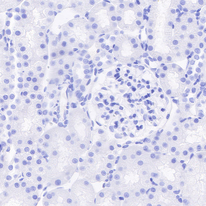 CAIX Recombinant Rabbit mAb (SDT-356-21)