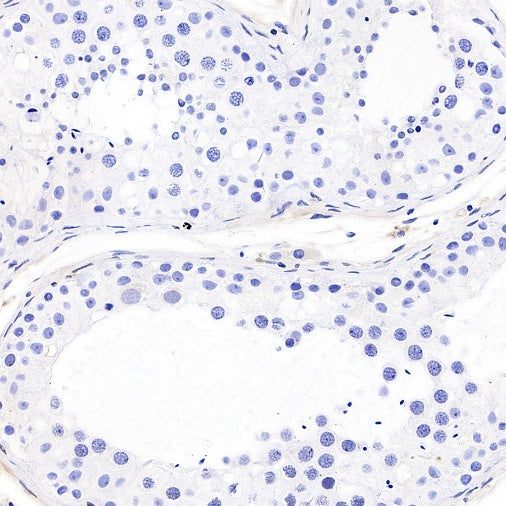STEAP3 Recombinant Rabbit mAb (S-4466-26)