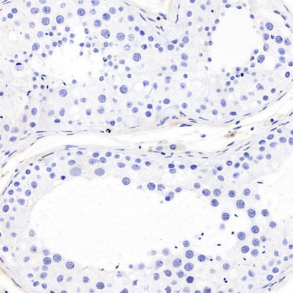 STEAP3 Recombinant Rabbit mAb (S-4466-26)