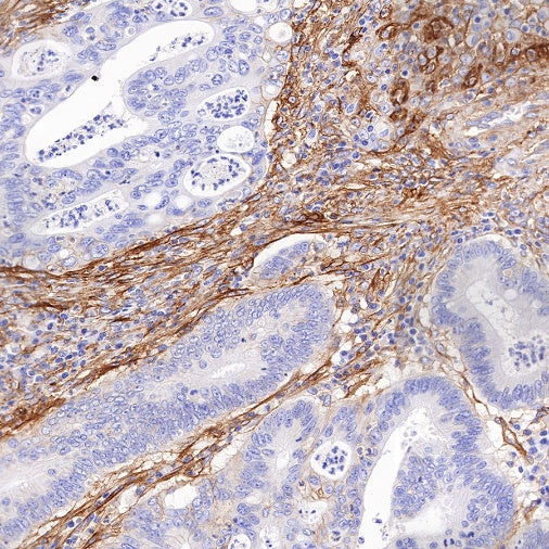 B7-H3 Recombinant Rabbit mAb (SDT-249-26)