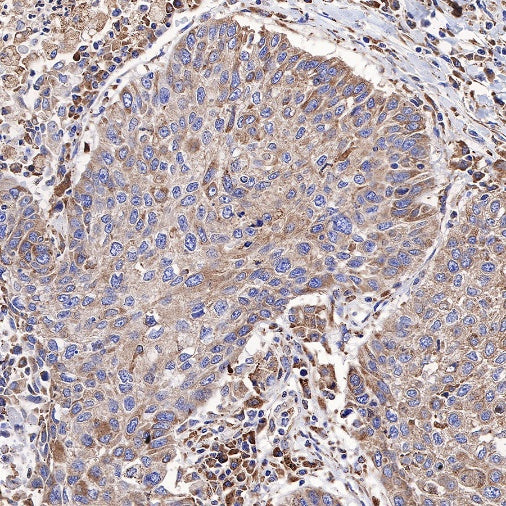 Calreticulin Recombinant Rabbit mAb (S-R353)