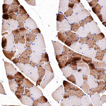 MYH7 Recombinant Rabbit mAb (S-4468-32)