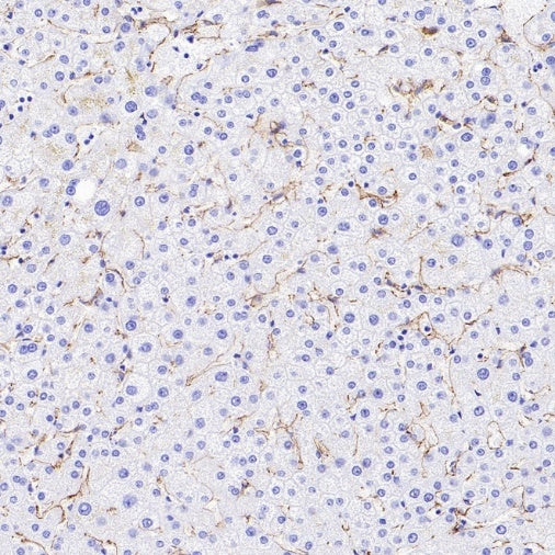 VE Cadherin Recombinant Rabbit mAb (S-3312-118)