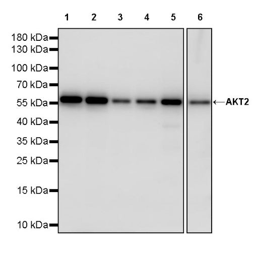 AKT2 Recombinant Rabbit mAb (S-2617-6)