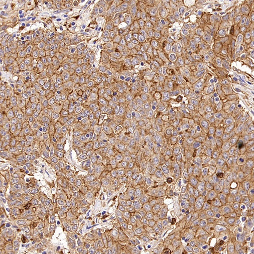 KIF18A Recombinant Rabbit mAb (S-3310-11)