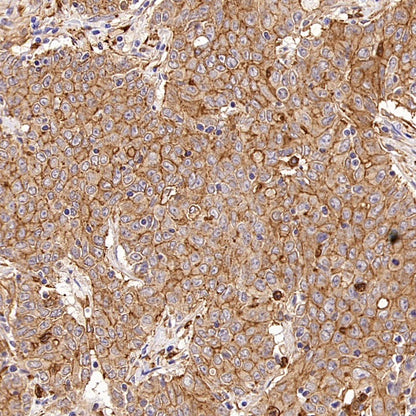 KIF18A Recombinant Rabbit mAb (S-3310-11)