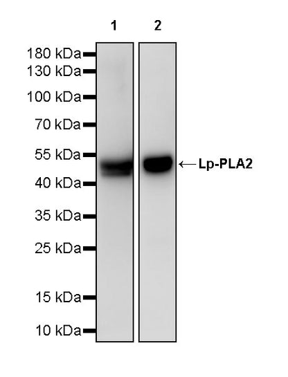 Lp-PLA2 Recombinant Rabbit mAb (S-3711-113)