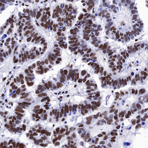 CREB Recombinant Rabbit mAb (S-1115-39)
