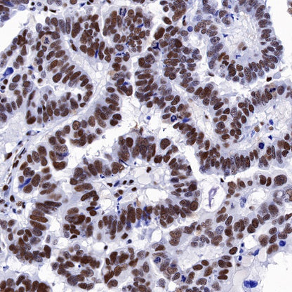 CREB Recombinant Rabbit mAb (S-1115-39)