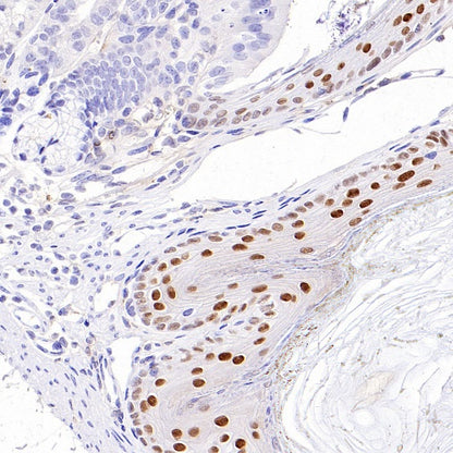 AP2α Recombinant Rabbit mAb (S-2376-7)