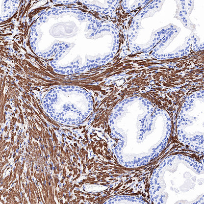 alpha smooth muscle Actin (SMA) Recombinant Rabbit mAb,PBS Only (SDT-132-63)