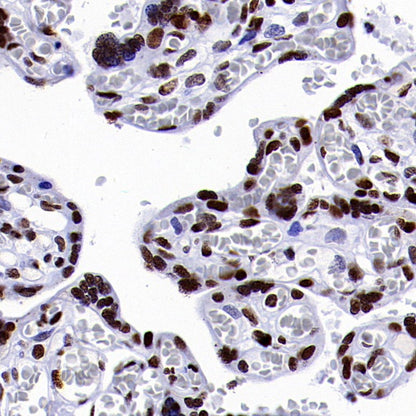 ENT2 Rabbit Polyclonal Antibody