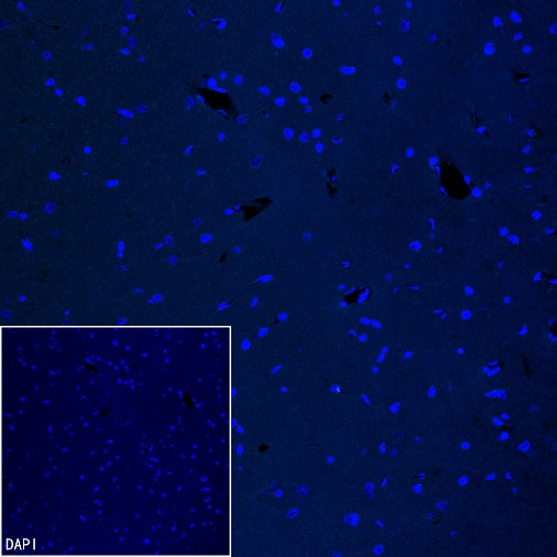 Coagulation factor V Recombinant Rabbit mAb (S-4489-58)