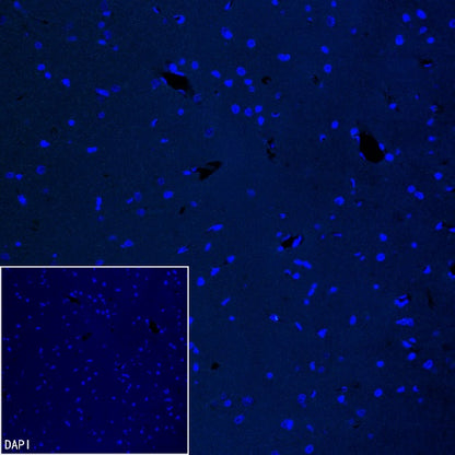 Coagulation factor V Recombinant Rabbit mAb (S-4489-58)