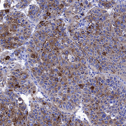 Glypican-3 Recombinant Rabbit mAb (SDT-4064-69-2)