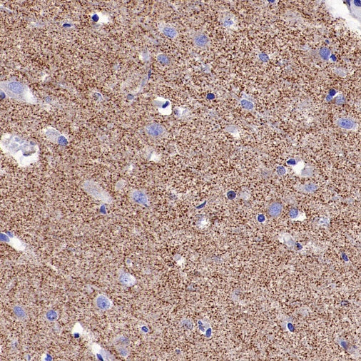 LRP1 Rabbit Polyclonal Antibody