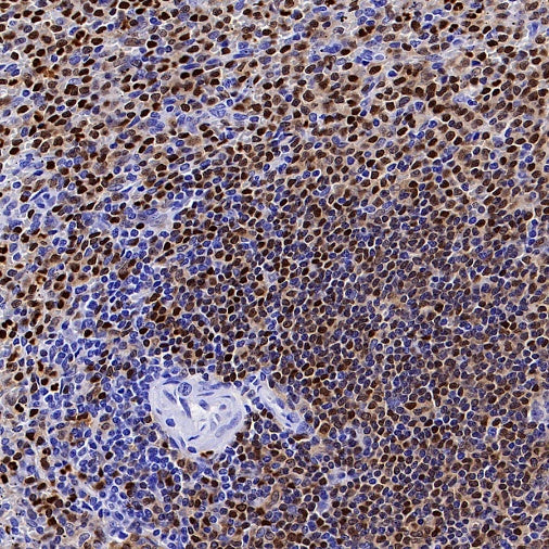 ALOX5 Recombinant Rabbit mAb (S-1980-27)