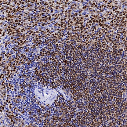 ALOX5 Recombinant Rabbit mAb (S-1980-27)