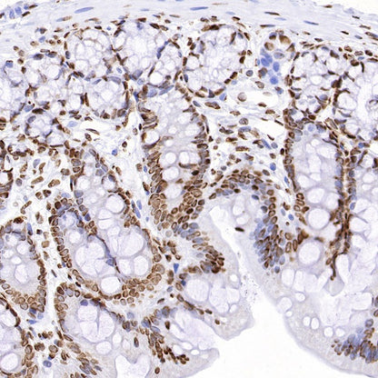 hnRNPK Recombinant Rabbit mAb (S-1645-45)