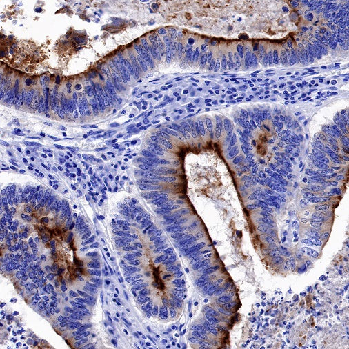 ACE2 Recombinant Rabbit mAb (S-1348-7)