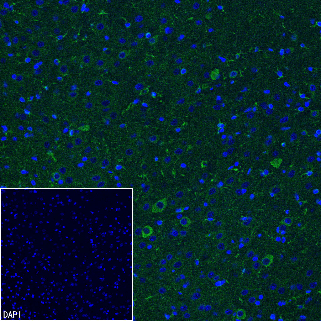PITX2 Recombinant Rabbit mAb (S-4009-54)