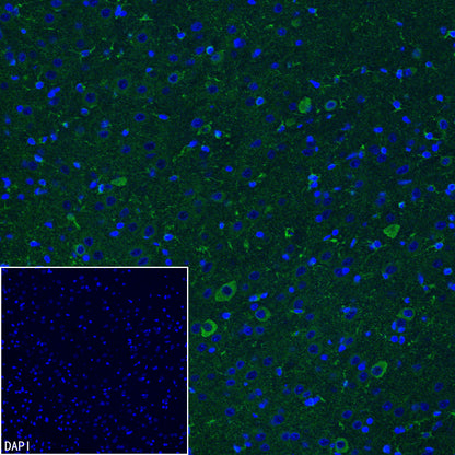 PITX2 Recombinant Rabbit mAb (S-4009-54)