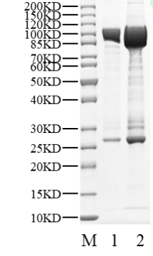 PKCβ2 His&GST Tag Protein, Human