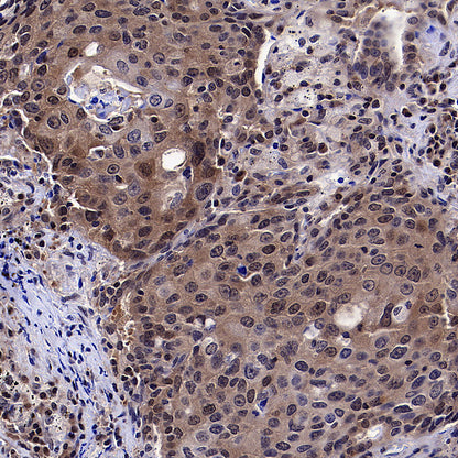 IRF3 Recombinant Rabbit mAb (S-3650-63)