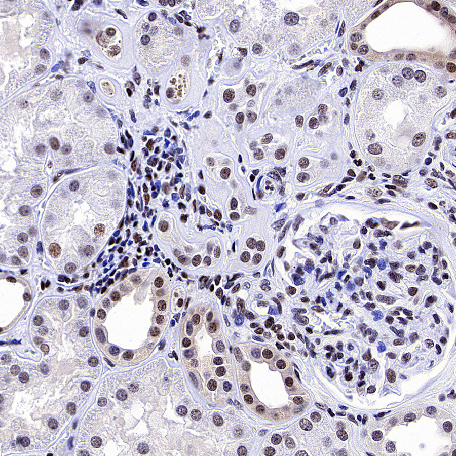 YY1 Recombinant Rabbit mAb (S-3652-44)