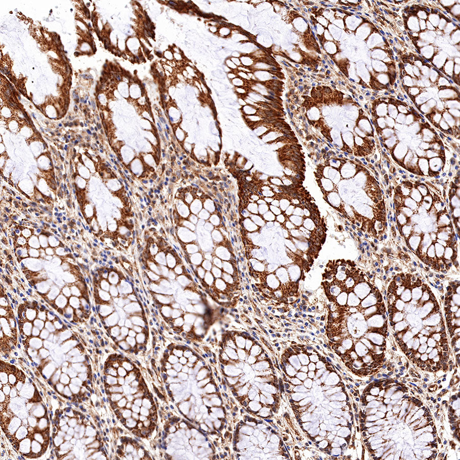 S-RMab® Stat6 Recombinant Rabbit mAb (SDT-337-32)