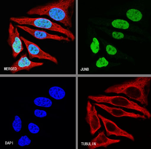 JunB Recombinant Rabbit mAb (S-670-242)